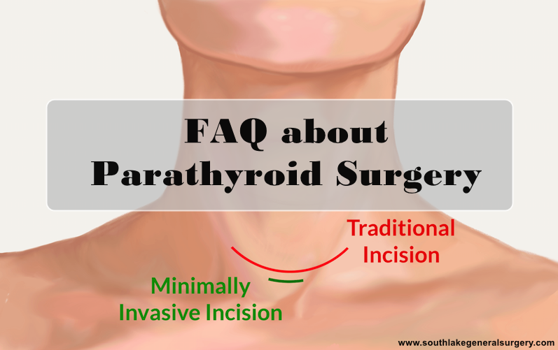 'Have questions about parathyroid surgery? 🏥 We've got you covered! Check out our latest blog post with all the essential FAQs to help you better understand the process and recovery.'💡 
Read more: southlakegeneralsurgery.com/faqs-about-par…
#ParathyroidSurgery #FAQs #Texas #southlaketx #healthcare