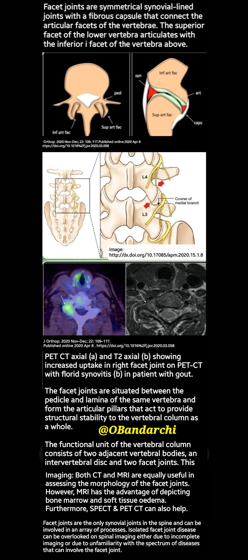 IFACET