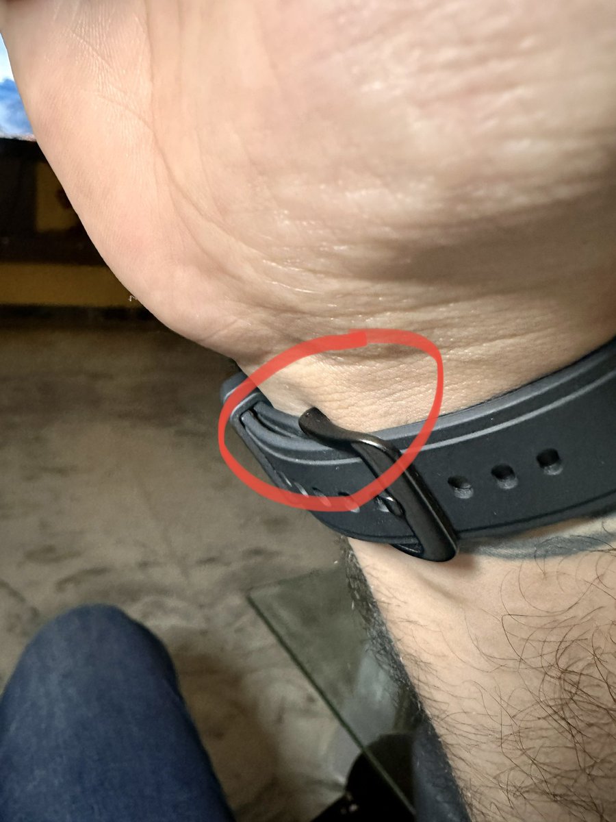 Dear <a href="/Samsung/">Samsung Electronics</a>, (<a href="/SamsungIndia/">Samsung India</a>) I've always admired your commitment to quality, which is why I'm rather surprised with my #SamsungGalaxyWatch4. The metal buckle is causing some discomfort, gently poking my wrist. 😟 While it's a minor issue, it's impacting my user experience.