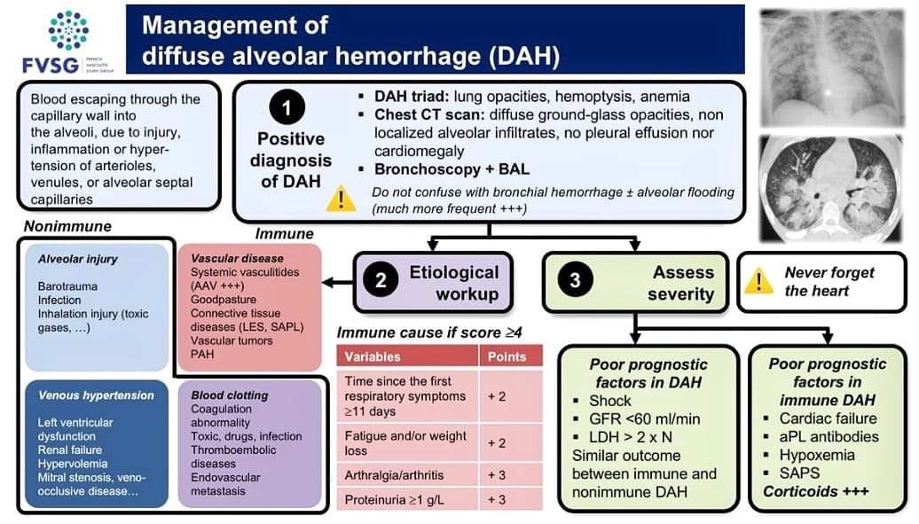 SayedSRahman1's tweet photo. Management of diffuse alveolar hemorrhage - French Vasculitis Study Group #DAH #vasculitis #FVSG #GFEV https://t.co/fc2fwMFwkU