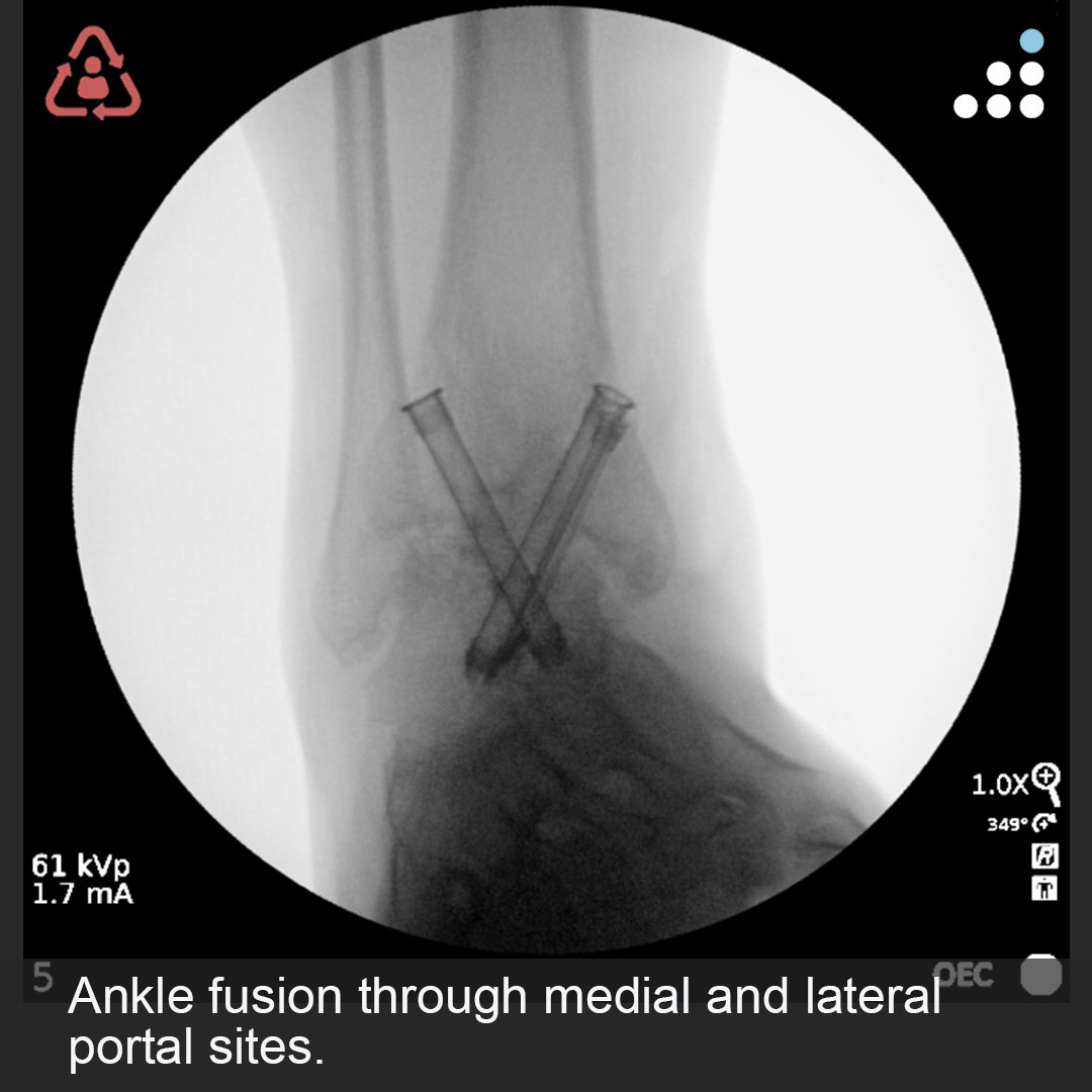 Orthobullets tweet media