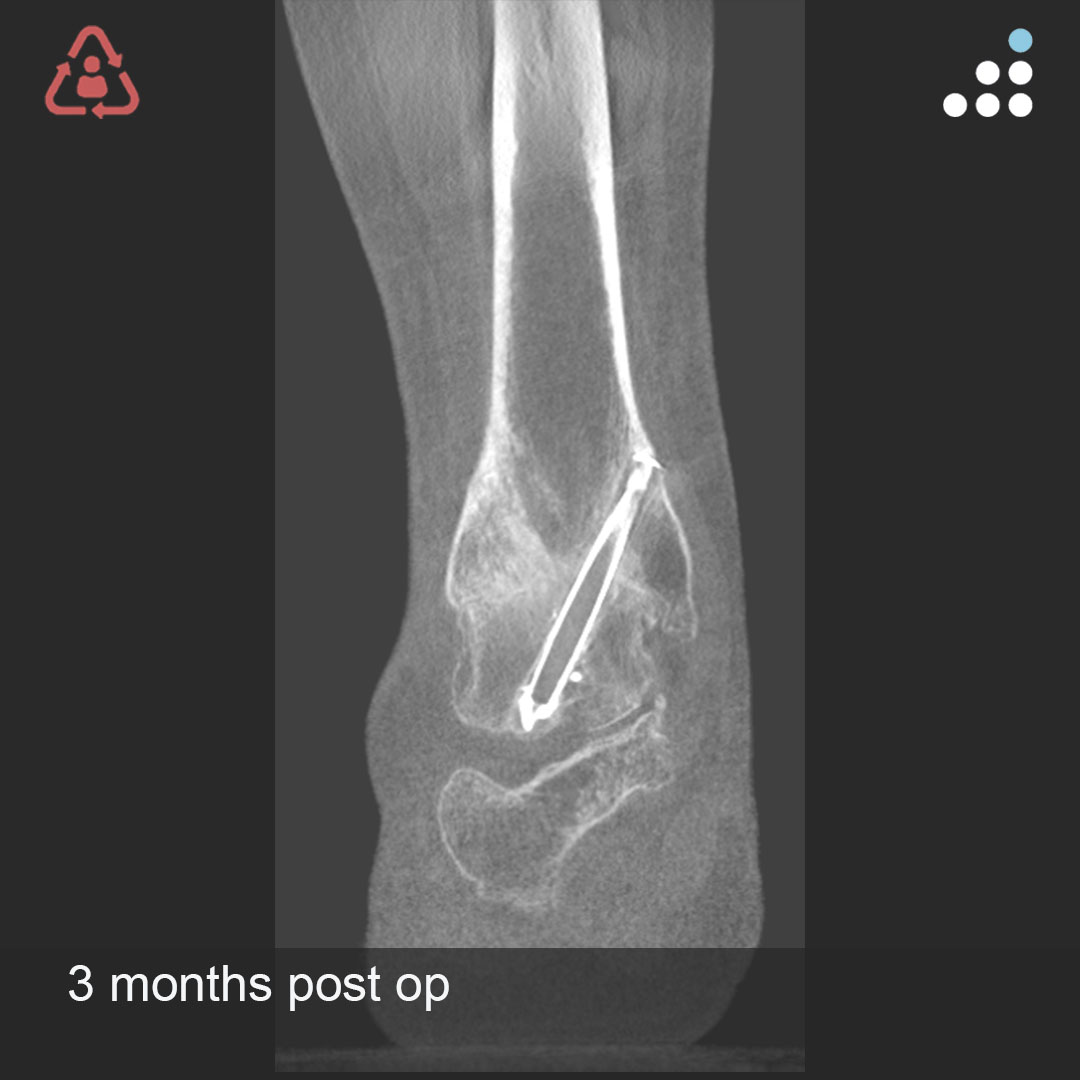 Orthobullets tweet media