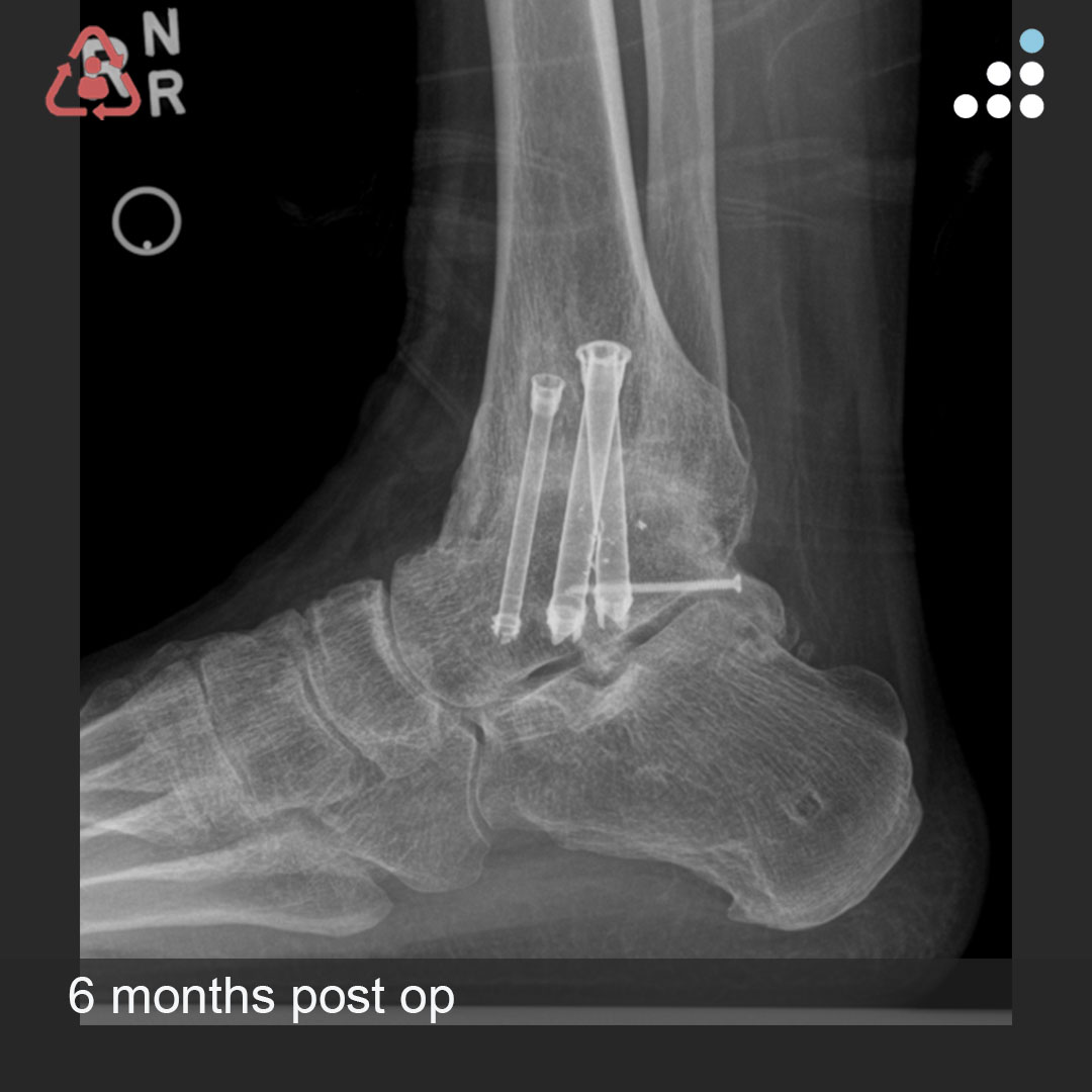 Orthobullets tweet media