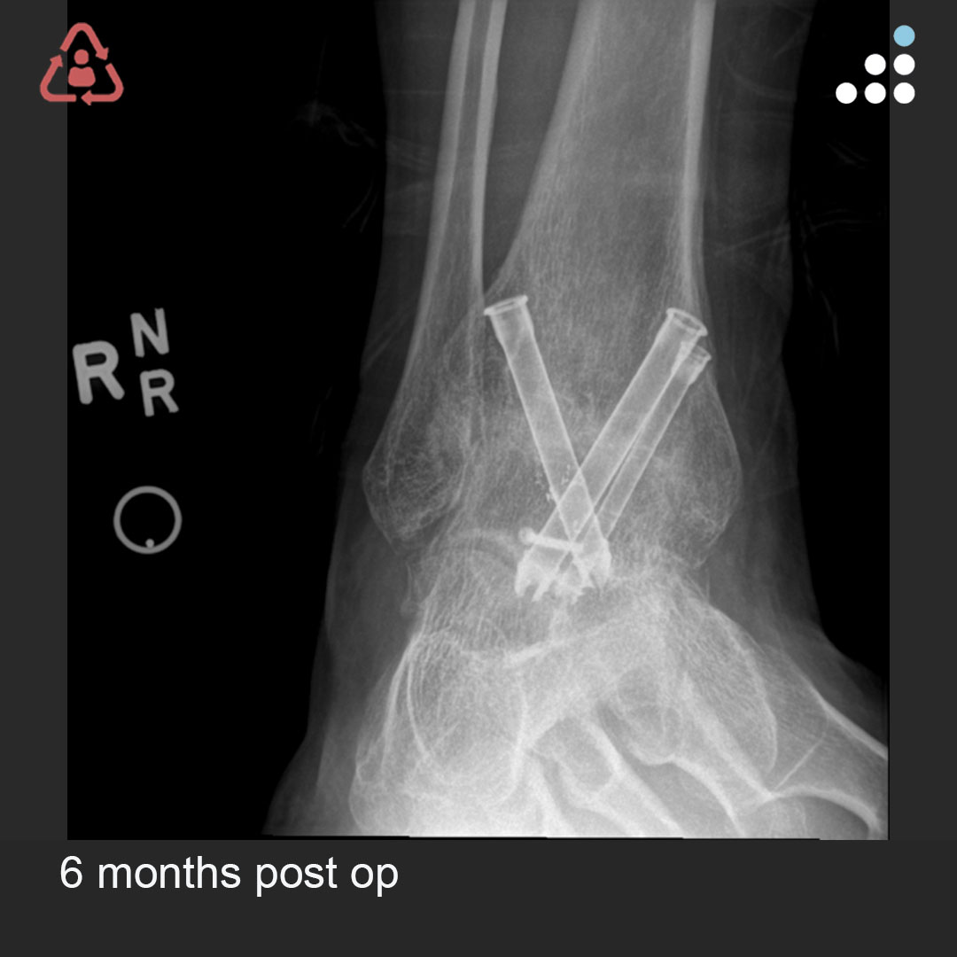 Orthobullets tweet media