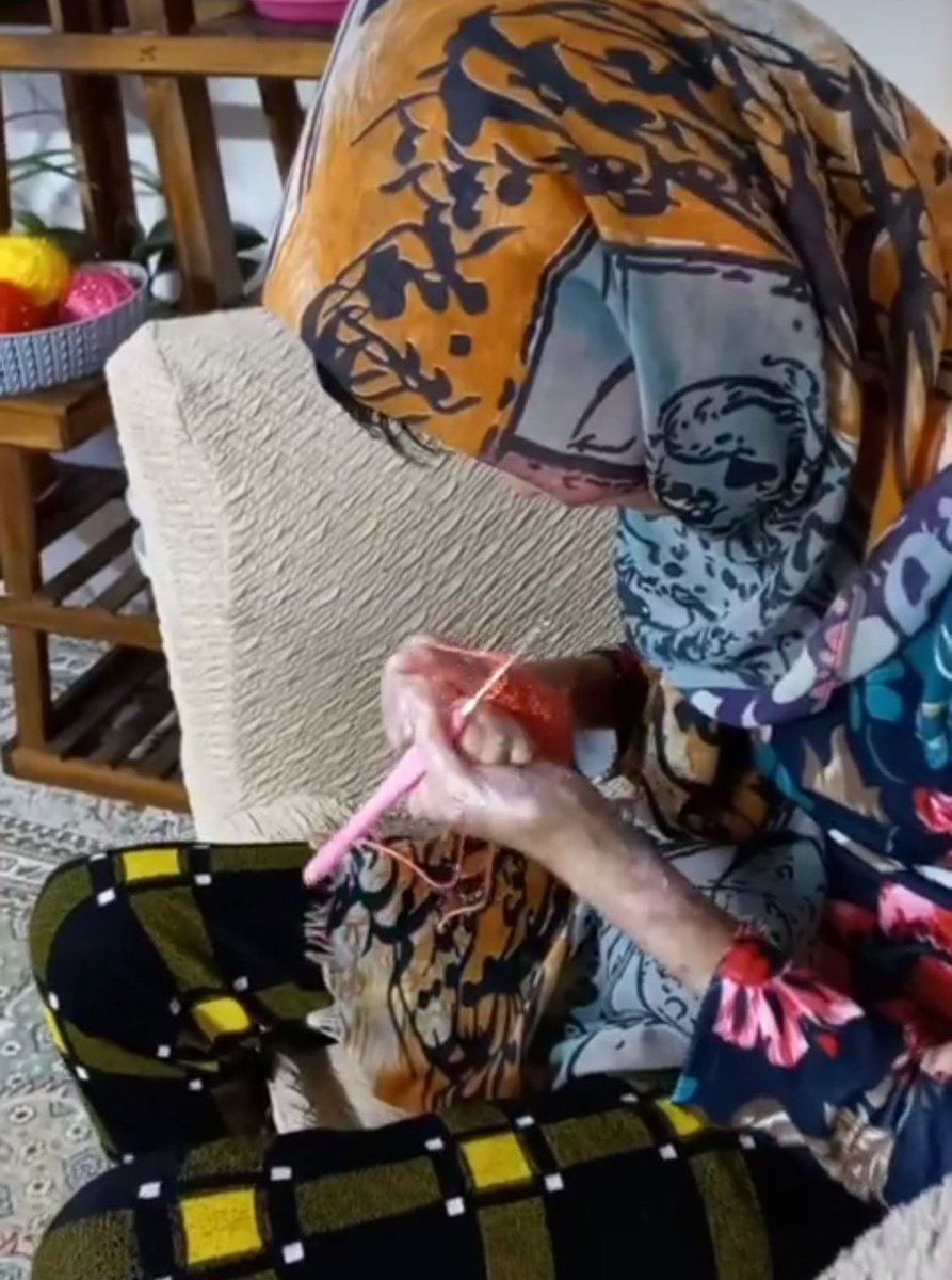 eb_melika's tweet photo. ✨سلام من ملیکا شفیع نیا هستم یک دختر پروانه ای یا همون(EB) بیماری(EB) یعنی درد، سوزش، تاول، زخم، رنج...💔 من عاشق کارهای هنری هستم
تازه واردم ممنون میشم هلم بدید😊❤️ https://t.co/KWTtcRdvNY