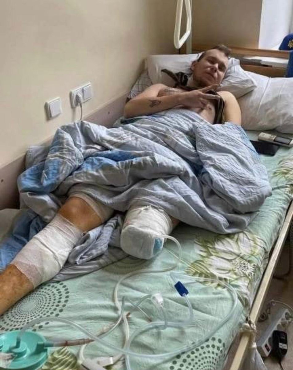 A Polish volunteer soldier has lost his leg in battle against the Russian Army

He has told the press that he will just quickly get a prosthesis and then return to the frontlines to keep fighting shoulder-to-shoulder with the Ukrainian Army.

🇵🇱🇺🇦