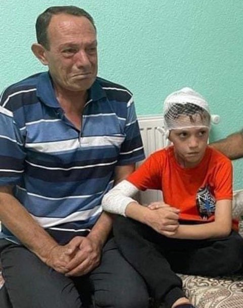 tonjukuk's tweet photo. Sol tarafta 20 lirasını çalmak isteyen sığıntıların kezzapla yaktığı 12-13 yaşındaki Yusuf Candan ve çaresiz babası, sağ tarafta dersane dönüşü bir Afgan’ın tecavüz edip başına taşla vurarak öldürdüğü 16 yaşındaki Ayşegül ve babasıyla son mutlu anı…

Unutmadım, unutmayacağım! https://t.co/3DPThUtoZh