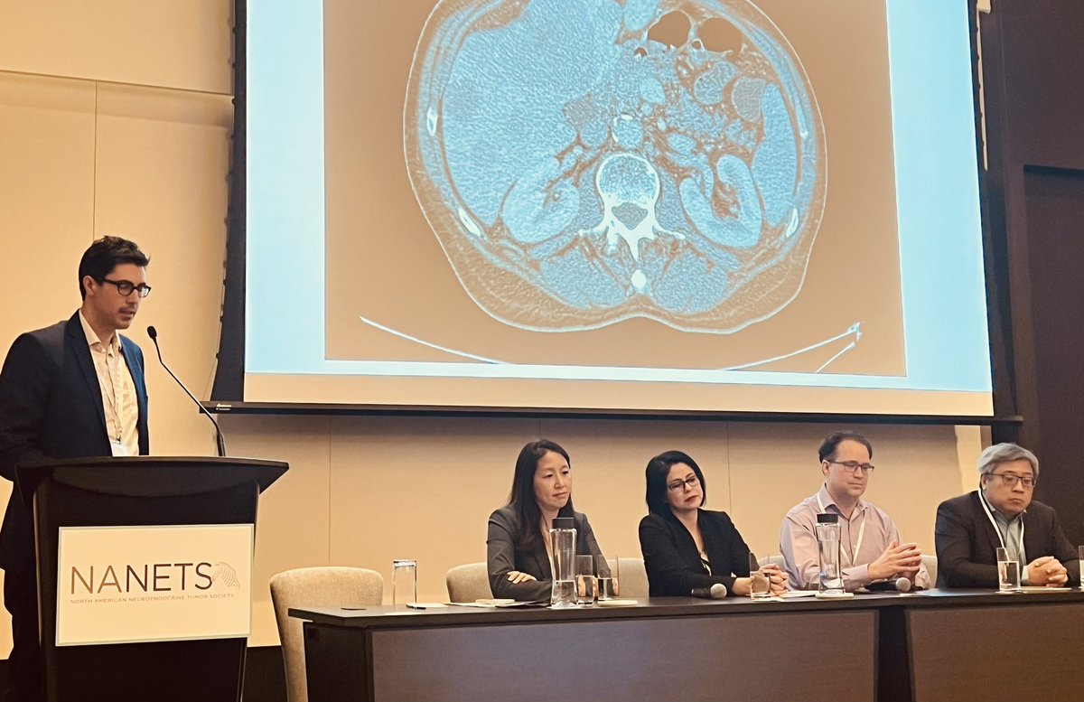 Julie Hallet (@halletjulie) on Twitter photo Pancreas, carcinoid🫀, 🫁 & small bowel NETs tumor board reviews to close <a href="/NANETS1/">NANETS</a> Toronto regional conference - can’t repeats it enough, multidisciplinary management is 🔑. Consider presenting #NETs to NET-focused tumor boards.
<a href="/DrCNClarke/">Callisia Clarke MD</a> <a href="/NadineMallak/">Nadine Mallak, MD</a> <a href="/AGangiMD/">Alexandra Gangi, MD</a> <a href="/AmanChauhanMD/">Aman Chauhan</a> Pancreas, carcinoid🫀, 🫁 & small bowel NETs tumor board reviews to close <a href="/NANETS1/">NANETS</a> Toronto regional conference - can’t repeats it enough, multidisciplinary management is 🔑. Consider presenting #NETs to NET-focused tumor boards.
<a href="/DrCNClarke/">Callisia Clarke MD</a> <a href="/NadineMallak/">Nadine Mallak, MD</a> <a href="/AGangiMD/">Alexandra Gangi, MD</a> <a href="/AmanChauhanMD/">Aman Chauhan</a>