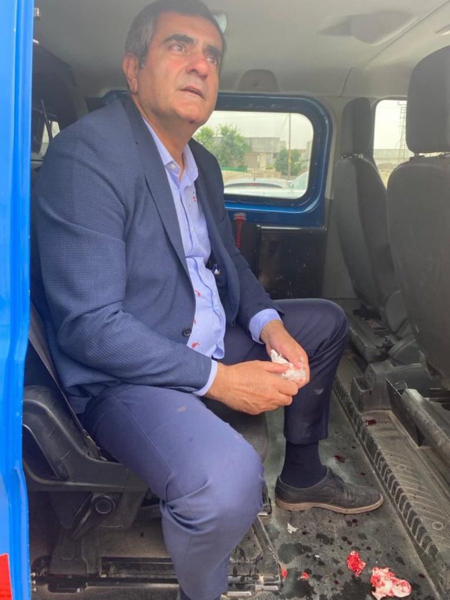 CHP Milletvekili Ali Şeker, Şanlıurfa Eyyübiye’de kadınların yerine oy kullanılmasını engellemeye çalışırken çıkan tartışmada darp edildi…