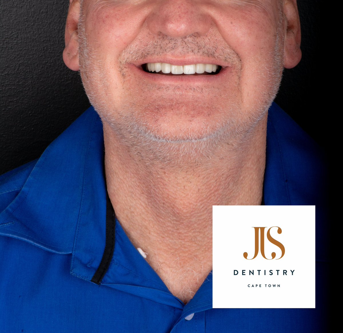 Much better!
SMILEMAKEOVER using adult braces and ceramic veneers and crowns.
#jjsdentistry #smilemakeover #capetown