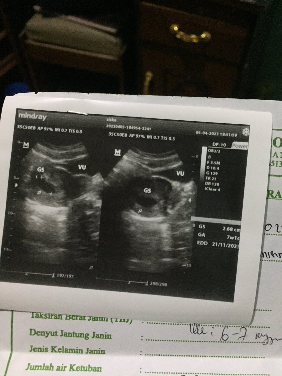 Siskafbrynt_'s tweet photo. MasyaAllah Tabarakallah🥰 https://t.co/KocPKMmCOr
