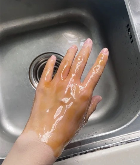謝謝哥哥們的關心  小小的手已經好多了 
沒有昨天晚上哪樣火辣辣的痛了哦
也有在乖乖敷藥  嘻嘻~
謝謝哥哥們的關心感恩❤ https://t.co/HGnE1xPyNA