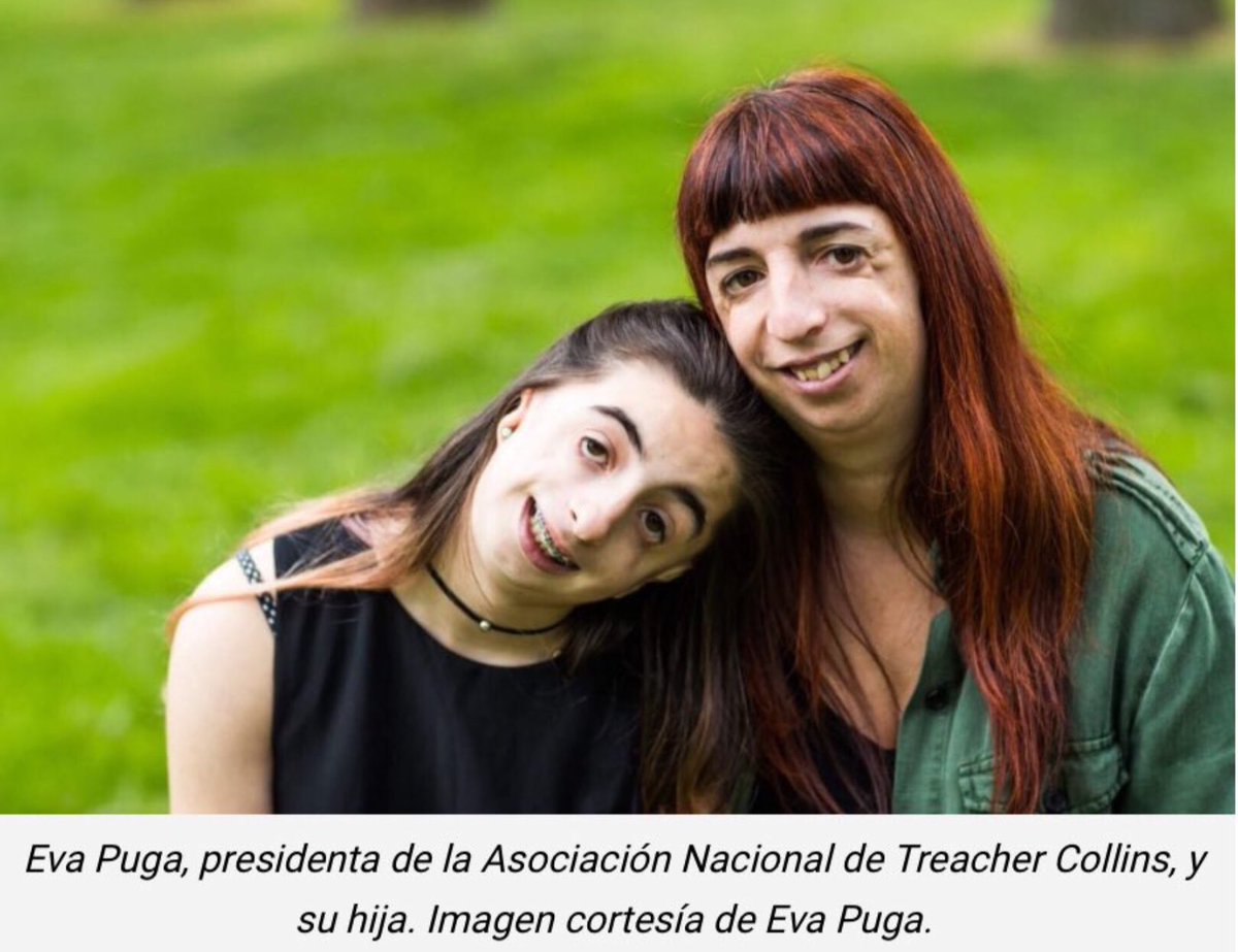 NoInvisibles's tweet photo. Es #TreacherCollinsDay #DiaTreacherCollins
Conoce ➕el Síndrome de #treachercollins en la entrevista de @CromatinaT y R. Megia en @genotipia a @Vicky_Bendito y @Evatreacherc:"No es justo que a las personas con #discapacidad, la vida nos cueste el triple”
https://t.co/E6Kwx5Txdr https://t.co/SvXQ8iTorD