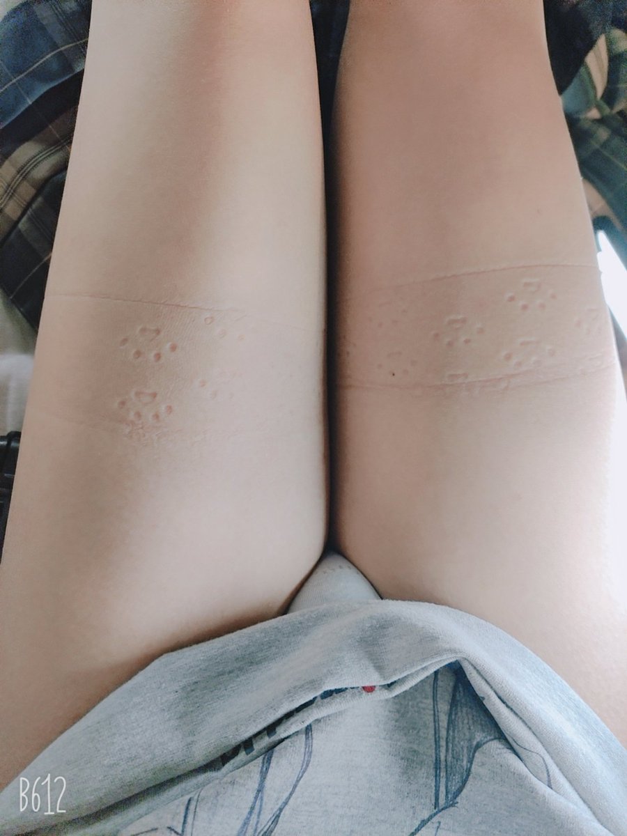 被猫猫踩了😭😭 https://t.co/i6mhAYNrGB