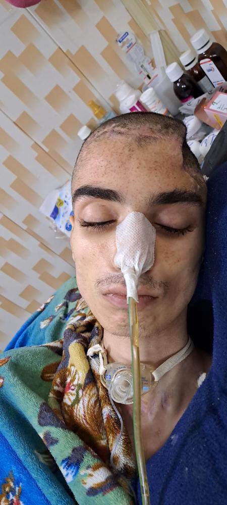 Abolfazl Amir Atai, a 16-year-old protester, died 
after being in a coma for 8 months due to the severity of the injuries.
 He was injured by the criminal IRGC  during the nationwide demonstration on September 31, 2022. 
#Iran #IranRevolution #HumanRights #IRGCIsTerrorist