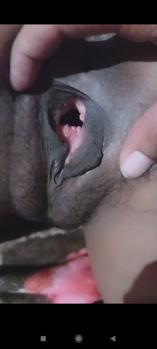 ssmithaah's tweet photo. My pussy before meeting my sugar daddy vs after https://t.co/8KSDpaMPUj