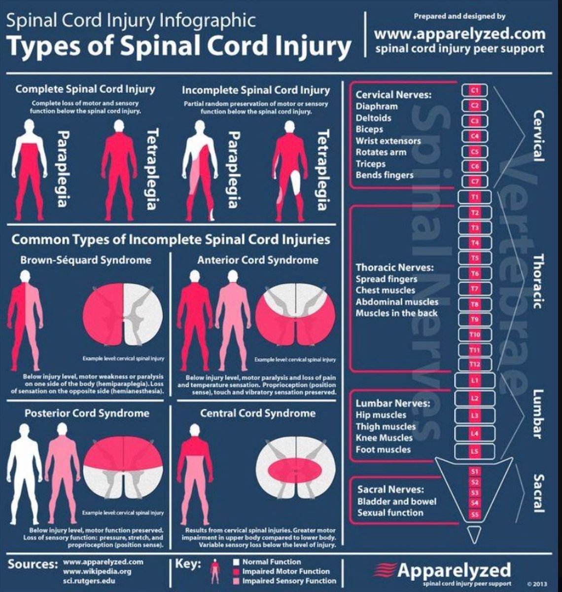 Types of spinal cord injury

#MedTwitter #Meded #neurotwitter 

Source: Apparelyzed.com