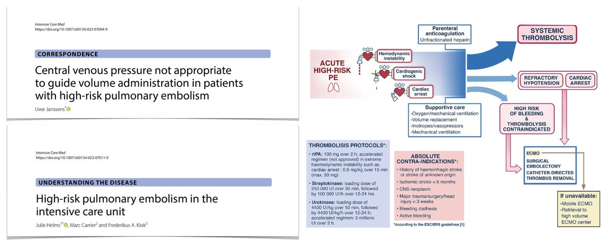yourICM's tweet photo. 💧CVP to guide volume administration?? Treatment of unstable high-risk PE pt remains major challenge: decision to give fluids should be individualized &amp; made with caution, combining hemodynamic &amp; imaging monitoring.
💦 https://t.co/zIMFUh6JYD

Refers to
🖇️ https://t.co/zlimZea3KP https://t.co/MXVlPNcfKN