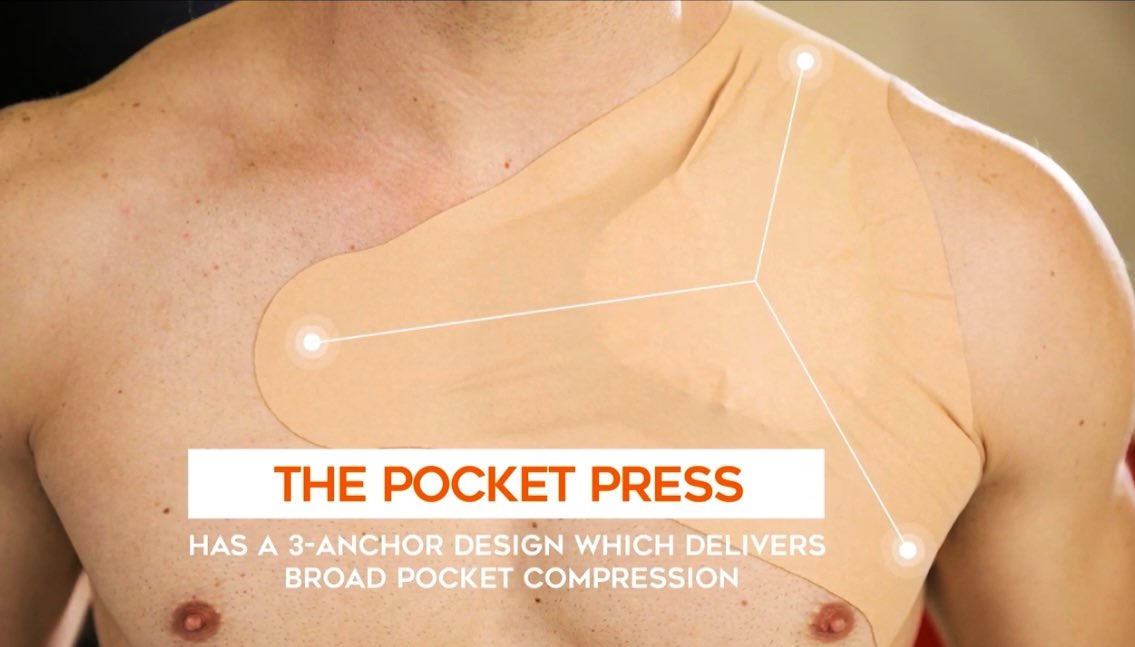 Just saw this at #HRS2023. It might not be as high tech as leadless pacing or PFA, but a CRM rep designed this specialized pressure bandage and has successfully launched it on his own. Love that entrepreneurial spirit!  
#nofinancialinterest 

pressuredressings.com