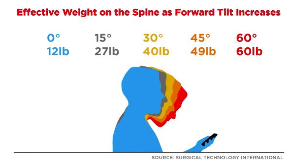 SocSurgErgo's tweet photo. @SeanLangenfeld @AmJSurgery @HFES @SAGES_Updates @AmerUrological @SocSurgOnc @urogynsociety @AcademicSurgery Compared to no headlight, yes. Anything adding weight to your dome is going to ⬆️ muscle activation/strain, esp if long case

Plus..

Headlight mounted to loupes ≠ over the head headlight w protruding light 

Cordless/battery powered ≠ Tower/light source powered with power cord https://t.co/2NYj0watSs