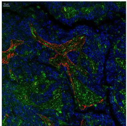 Standard_BioT's tweet photo. IMC™ Trending Topics News is all about you!
Check this news section regularly to see a current selection of exciting announcements and stories about researchers who are using #ImagingMassCytometry to make an impact.
https://t.co/WdSJYQsdYd #IMCnews #awards #publications https://t.co/zyxwroYQN4