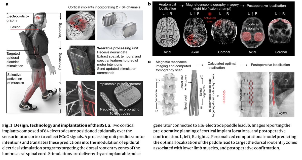 An AI-powered Brain-Spine Interface (BSI) helps a paralyzed man to WALK AGAIN!

In a medical breakthrough, Swiss researchers used AI to enable a paralyzed man to walk again after 12 years 🤯

This AI-powered BSI decodes and translates the brain signals into commands for muscle