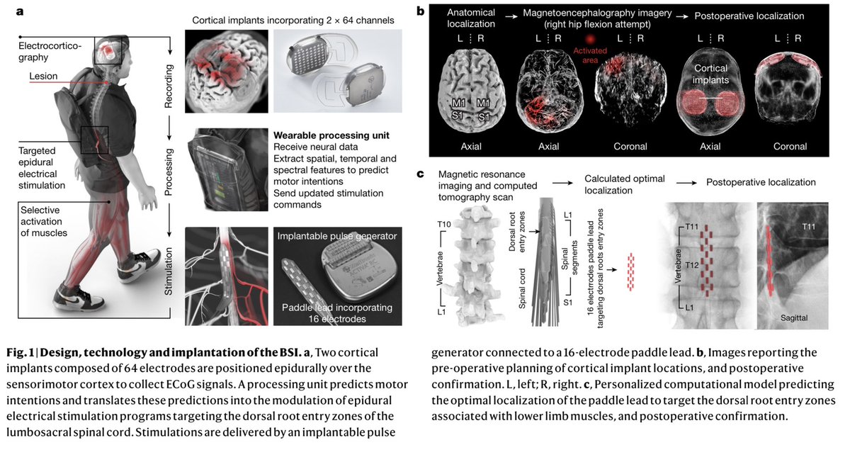 An AI-powered Brain-Spine Interface (BSI) helps a paralyzed man to WALK AGAIN!

In a medical breakthrough, Swiss researchers used AI to enable a paralyzed man to walk again after 12 years 🤯

This AI-powered BSI decodes and translates the brain signals into commands for muscle…