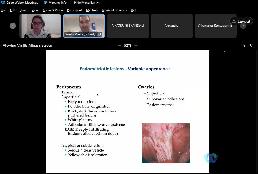 IncisionGR's tweet photo. A review of our Surgical training programme!

Vasileios Minas, Gynaecologist, Endometriosis Specialist
Θεραπεία &amp; Χειρουργική αντιμετώπιση ενδομητρίωσης"
#incisiongreece #globalsurgery #surgery #obgyn #gynaecology #endometriosis #greekmedicine #greekdoctors #uk #greece https://t.co/LmG7ixUYOD