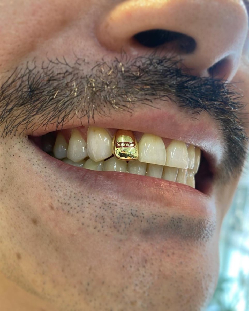 Supreme small Box Logo Grillz 1 of 1 

Made for the Supreme Shibuya store manager