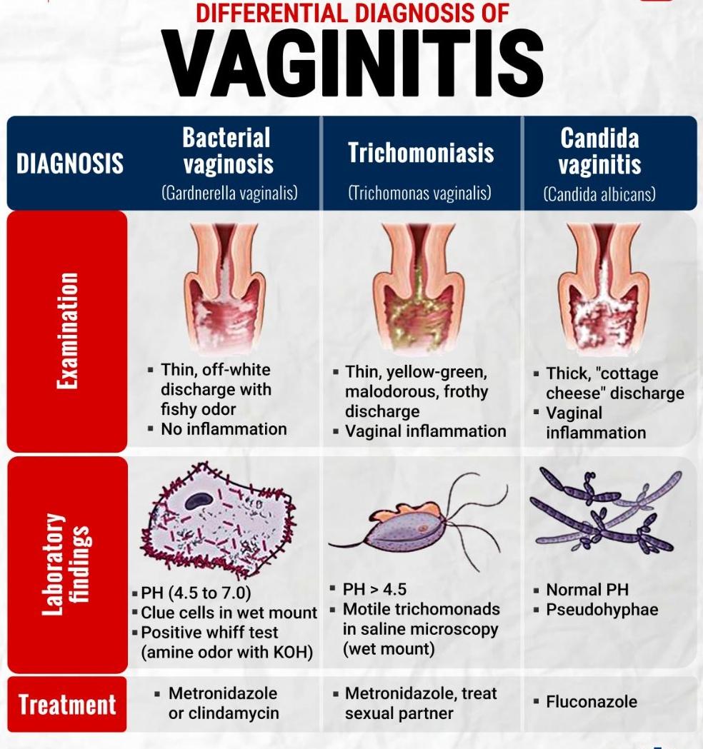 Differential Diagnosis of
 VAGINITIS🥰👇

By. MedNote Collection