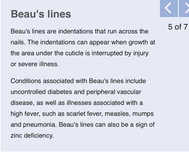 DrShady_Yousif's tweet image. 💠Beau’s lines.
✅Dx:
1️⃣Correspond to the start of each chemotherapy cycle w/ distance between lines proportional to interval between cycles.
2️⃣Cytotoxic chemotherapeutic agents induce temporary arrest of proliferative function of the nail matrix.
@IhabFathiSulima