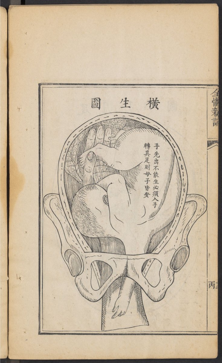 freddshann's tweet photo. In our collection at @utlibraries, there is a Japanese 1874 remake/translation of the Quanti xinlun by Benjamin Hobson, first published in Shanghai in 1851. The 1874 Japanese edition redid the illustrations with copperplate. Chinese version from Harvard: https://t.co/OSD3tppDIp. https://t.co/kjxUoSxVNT