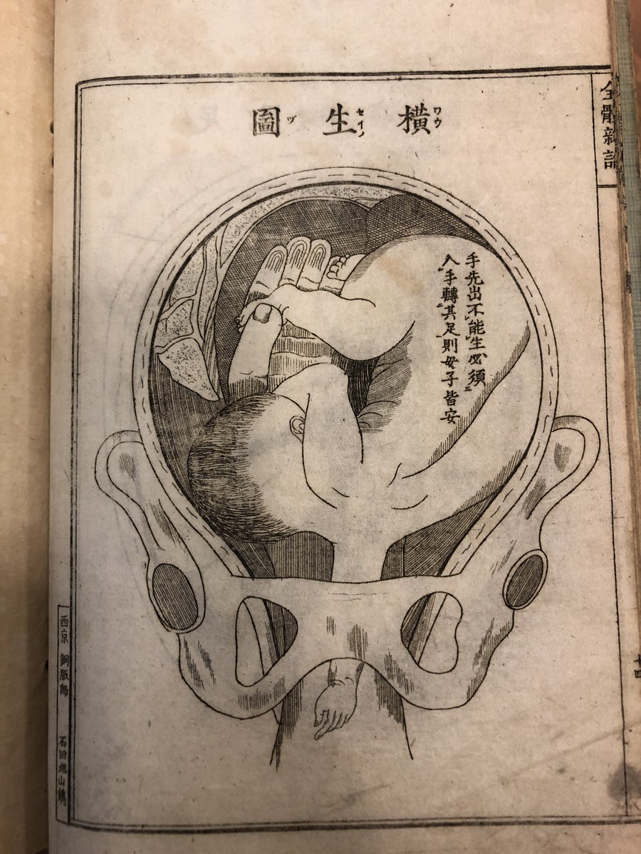 freddshann's tweet photo. In our collection at @utlibraries, there is a Japanese 1874 remake/translation of the Quanti xinlun by Benjamin Hobson, first published in Shanghai in 1851. The 1874 Japanese edition redid the illustrations with copperplate. Chinese version from Harvard: https://t.co/OSD3tppDIp. https://t.co/kjxUoSxVNT