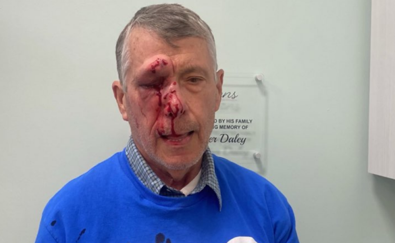LifeNewsToo's tweet photo. BREAKING: Abortion Advocates Brutally Assault Pro-Life People Outside Planned Parenthood https://t.co/a4hlQC1EFk https://t.co/bBvCDXGLJu