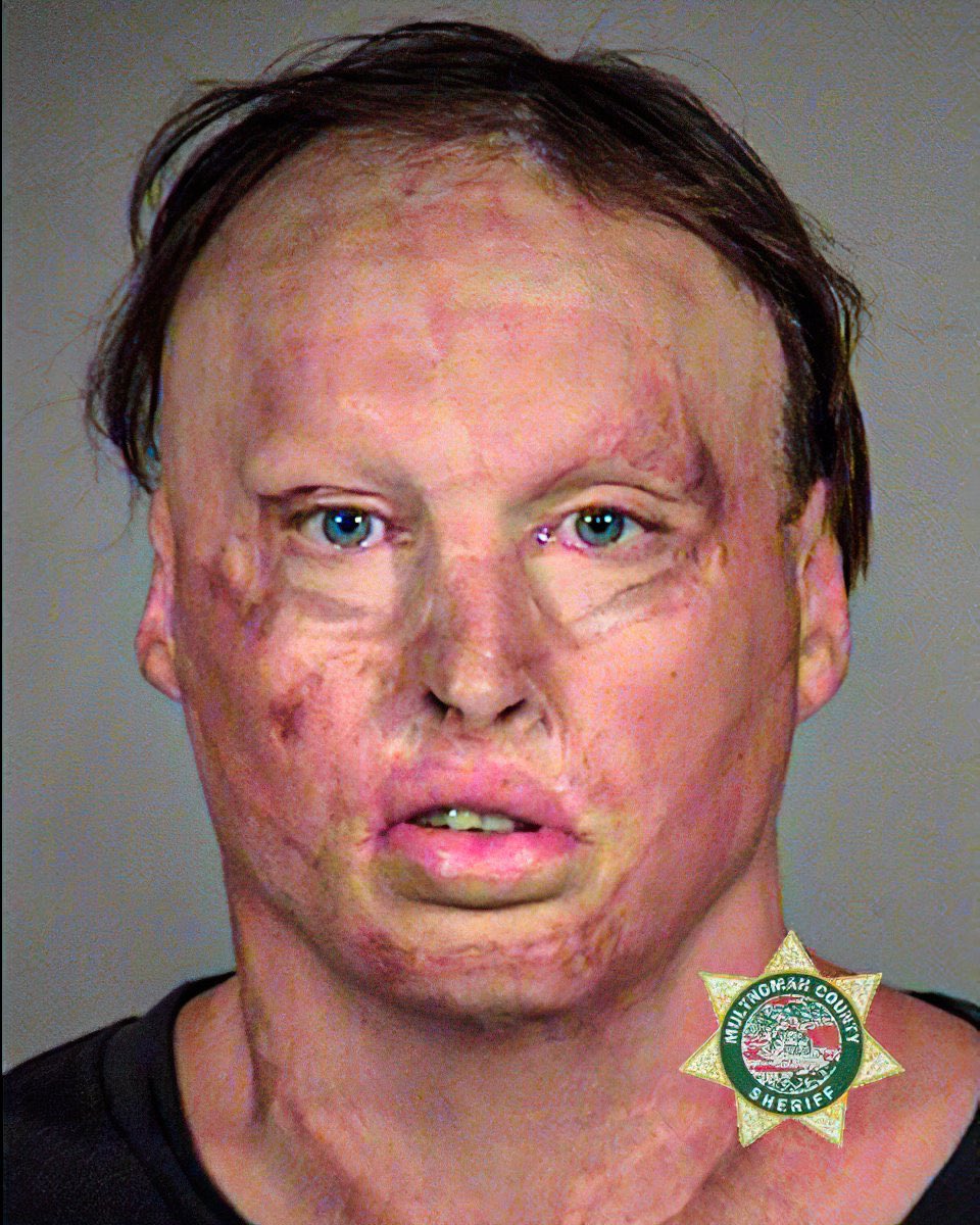 MrAndyNgo's tweet photo. It has been two years since Antifa members in Portland beat me severely on May 28, 2021, leading to another hospitalization. They tried to break inside a hotel lobby to kill me after I escaped their assault on the street.

I’m suing Antifa members John Hacker and Elizabeth Richter for their alleged role in that attack. Read & support the lawsuit here: https://t.co/IX9EAJCJ4g