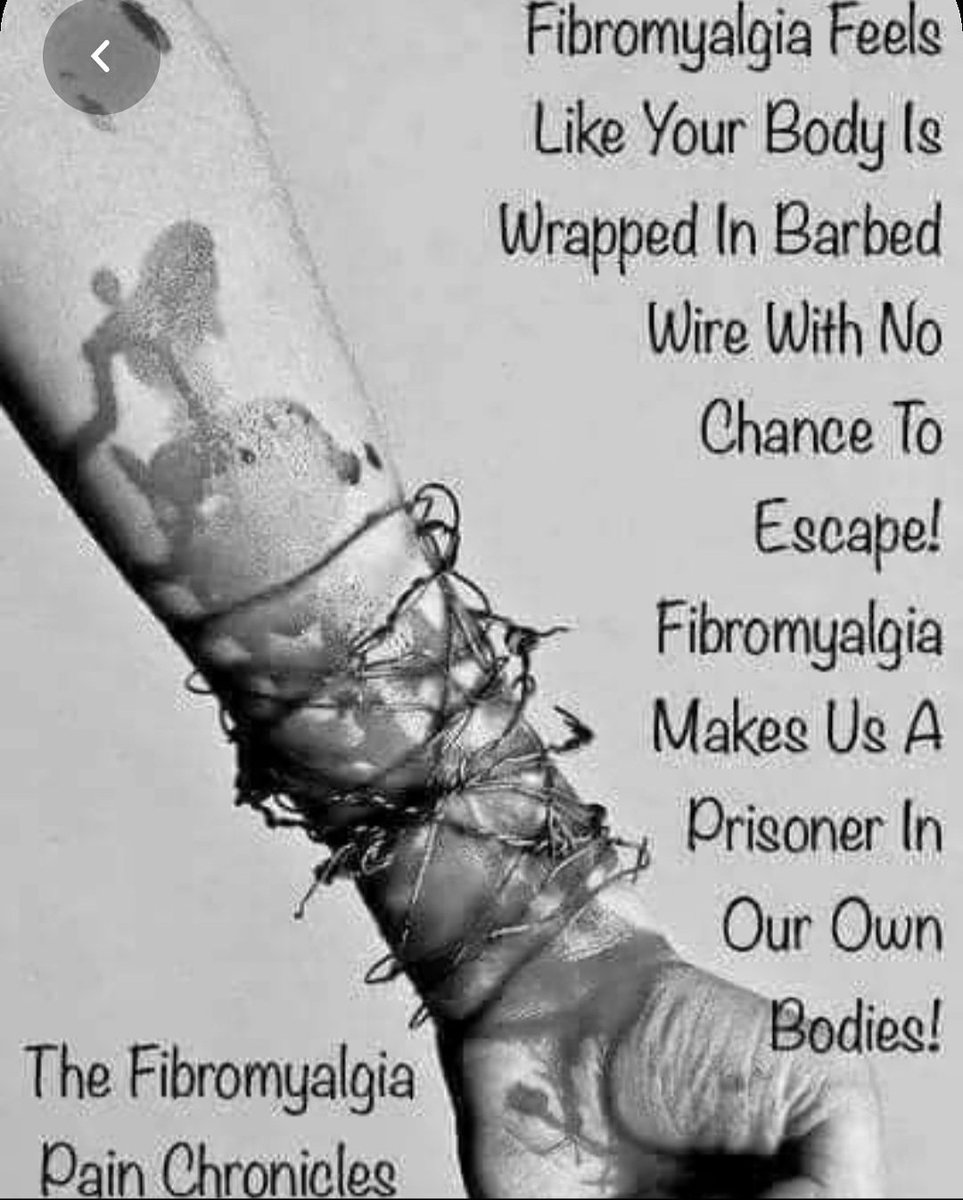 Fibromyalgia...
#widespreadpain #chronicpain #nervepain  #pinsandneedles 
#fibromyalgia #CFSME 
#fibrosupportbymonica
