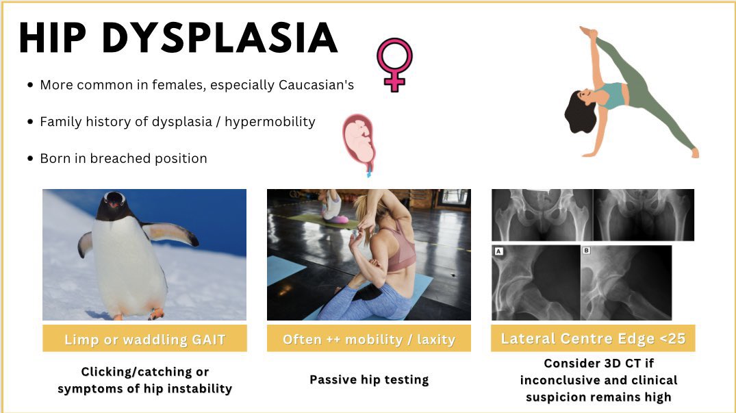 meemo_Hakami's tweet photo. 📍ملخص يجمع كل hip differential diagnosis  . وتوضيح  كل من :

-  special test المعتمده في تحديد التشخيص 👍

- صوره المرض بالاشعه والعلامات الاساسيه
 
-الاعراض المتشابهه 

_ referred pain 

_gait changes https://t.co/125Ez9ZkK8