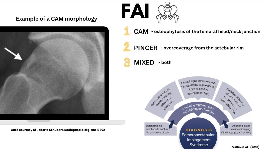 meemo_Hakami's tweet photo. 📍ملخص يجمع كل hip differential diagnosis  . وتوضيح  كل من :

-  special test المعتمده في تحديد التشخيص 👍

- صوره المرض بالاشعه والعلامات الاساسيه
 
-الاعراض المتشابهه 

_ referred pain 

_gait changes https://t.co/125Ez9ZkK8