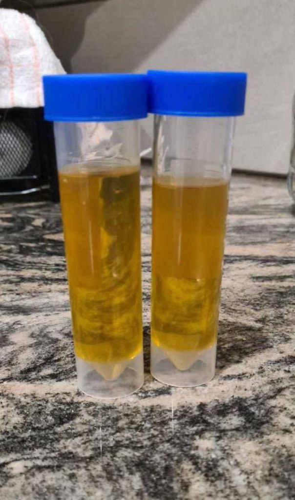 ShroomLordJerry's tweet photo. 5MeO DMT cart liquid refilled. https://t.co/qCOHE3mm63