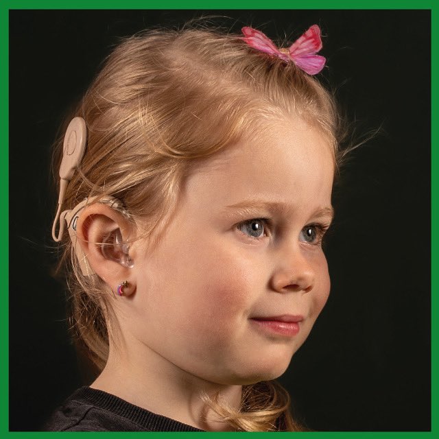 Tomorrow is the big day! Get ready for the SuperHEARoes Photo Exhibition in Rotterdam, starting from May 30 to June 13, 2023. Experience the inspiring portraits of children with cochlear implants at Kruisplein. Don't miss out! Free admission! #SuperHEARoes #CochlearImplant #espci