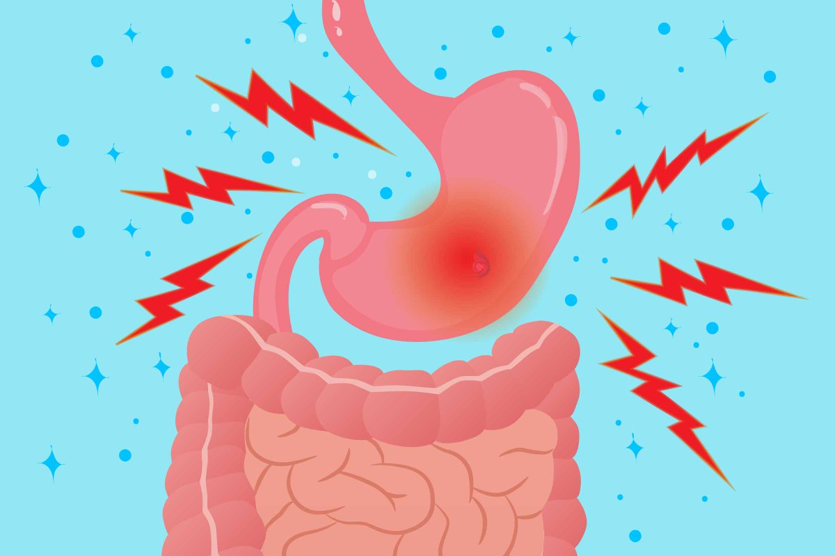 HopeAndBeyondUg's tweet photo. Today is the "World Digestive Health Day". 

It is aimed at raising awareness about digestive disorders and emphasize the significance of timely diagnosis and treatment for gastrointestinal diseases.

#WDHD

Photo credit: @CreakyJoints https://t.co/qsq6ZUkOAg