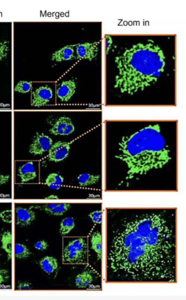 A close up of the image showing mitochondria fragmentation, with alt text. Someone just taught me how to do it