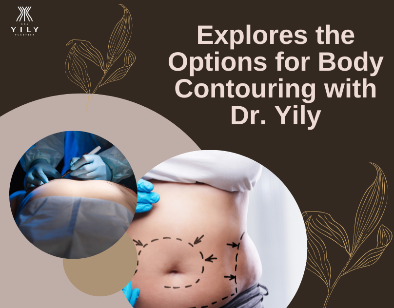 YilyPlastica's tweet photo. Let's talk about removing excess skin after weight loss. A #tummytuck, also known as #abdominoplasty, is another form of body contouring.
I tell you more here 👇 https://t.co/NHhCegPRYL #draYilydeloSantos #YilydeloSantos #yily #draYilydelosSantos #YilydelosSantos https://t.co/sYUGRvI4zs