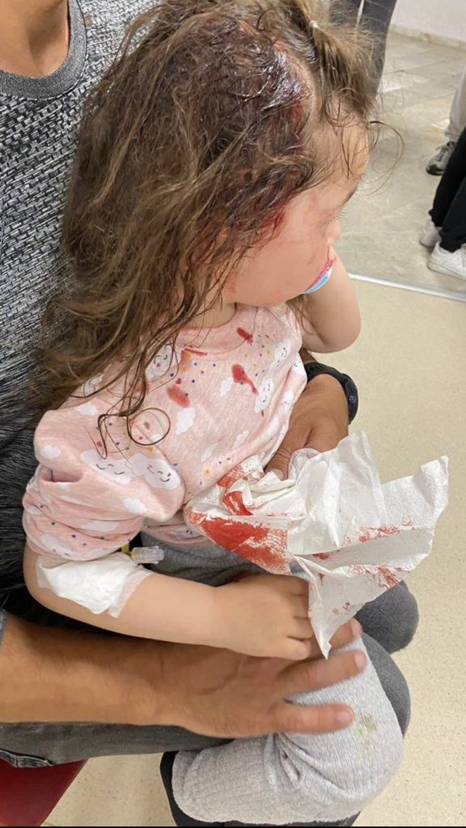 Bu prenses 4 yaşında ❤️ ve başıboş sokak köpeklerinin saldırısına uğramış. Allahıma çok şükür sıyrıklarla kurtulmuş. Biz sizlere oy verdik be bu sorunun çözümünü bekliyoruz. Artık tahammülümüz kalmadı..! <a href="/TBMMresmi/">TBMM</a> <a href="/Akparti/">AK Parti</a>