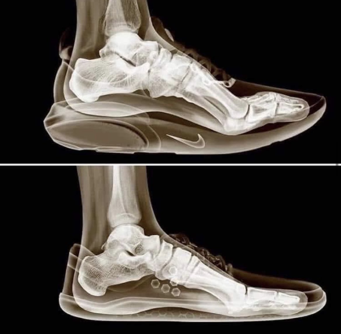 JulioFdez79's tweet photo. Una increíble ilustración de lo que la mayoría de los zapatos modernos (muchos fabricados por
Nike, Adidas, etc.) le hacen a nuestros pies en comparación con un zapato normal. 
La diferencia más notable está en la posición de los dedos. https://t.co/rglVDQK9la