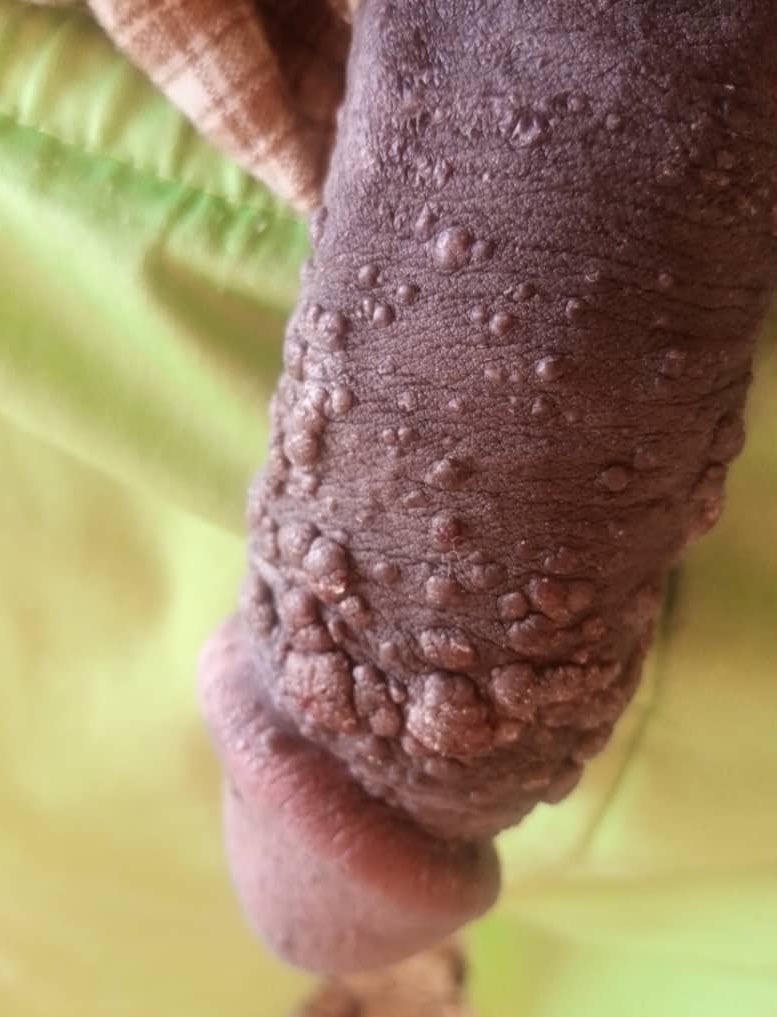 GYerathel's tweet photo. Gents condom is a must !! https://t.co/qWDx9GDcV8