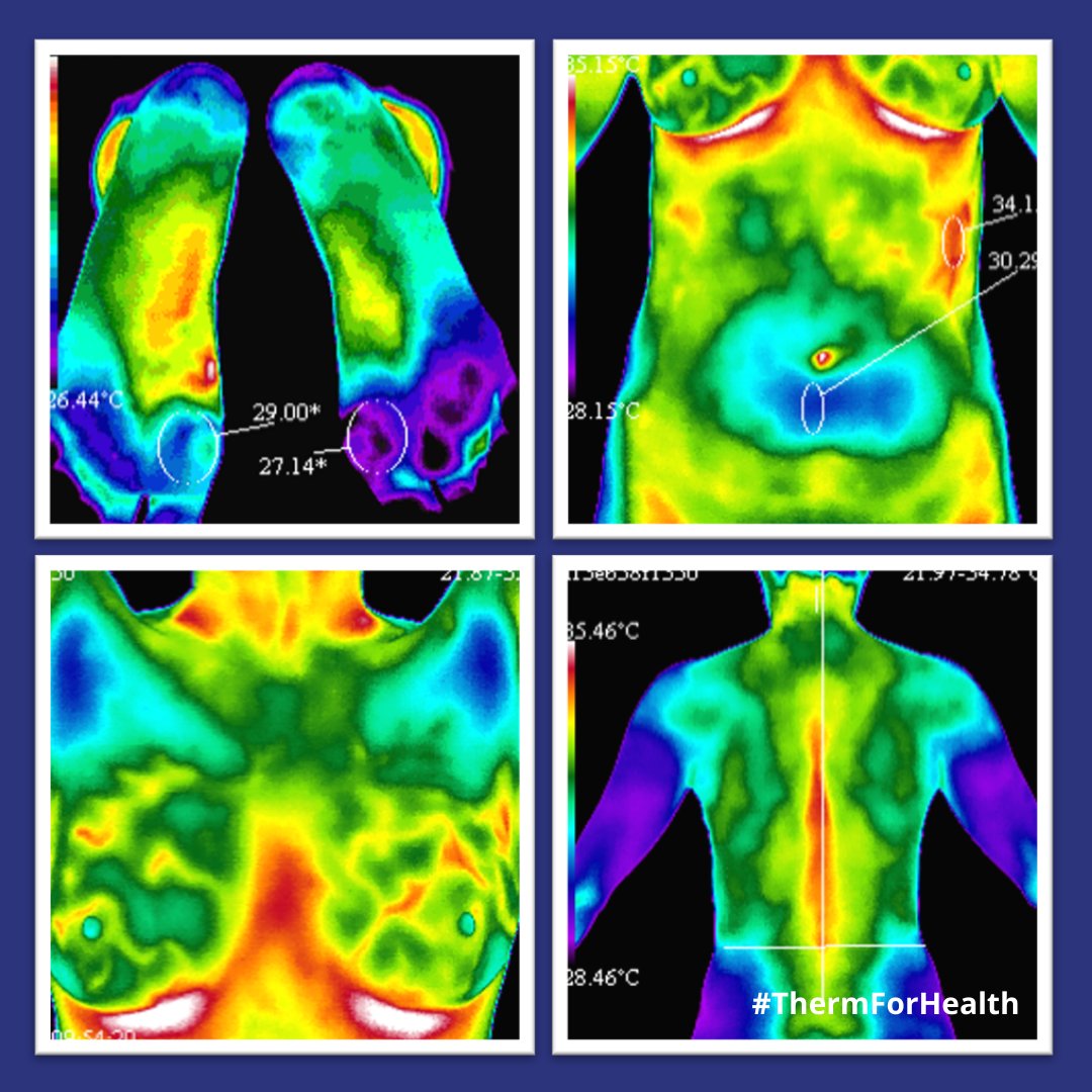 No radiation, no pain, and no body contact.
Thermography is a better way to scan your body for health!

Call Our Office to Schedule Your Scan: 212-838-8884

#thermforhealth #thermographynyc #clinicalthermography #noradiation #earlydetectionsaveslives
