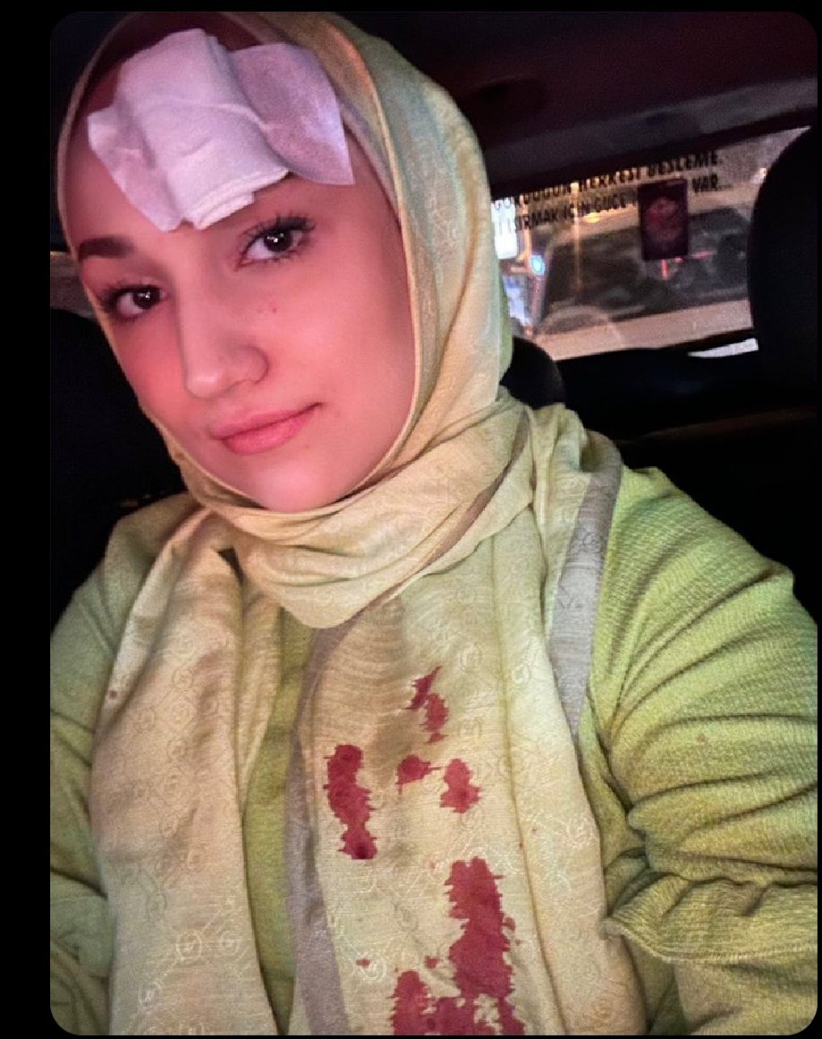 NilKa_'s tweet photo. @eacarer Onun endişe etmesine gerek yok endişe edeceksek biz edelim...Bak mesela bu hanımefendi başörtülü ve ak partili olduğu için dün İzmir'de vandallar tarafından taşlandı.Yani siz olayları dramatize ederken diğer yandan yaşanan bir takım gerçekler var... https://t.co/1Srplo2cLW