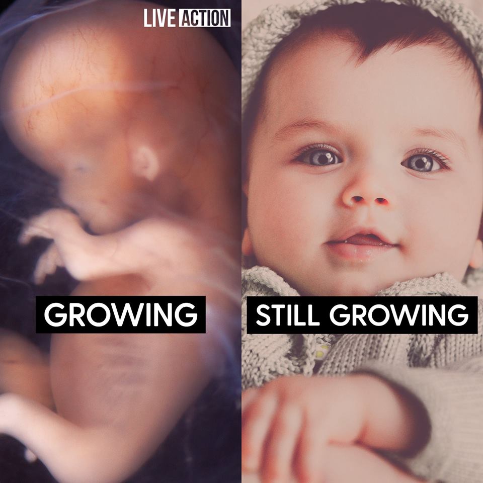 At even the earliest stages, a developing embryo has all the necessary characteristics of a human being. All she needs is time and nourishment to grow.