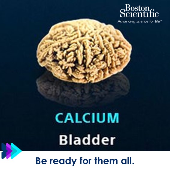 BSCEMEA_Urology's tweet photo. Do you want to provide treatment options that help patients to become stone-free as quickly and safely as possible? 

Learn more about how our extensive portfolio can support your #Endourology practice: https://t.co/DmEqzRlHMe

#BSCEMEA #AnyStone https://t.co/yCEXHo5f51